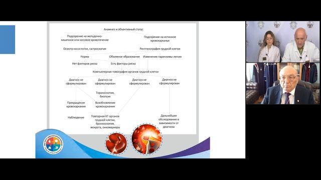 Амбулаторный Экспресс. Туберкулез в практике терапевта. 11.06.20 смотреть онлайн