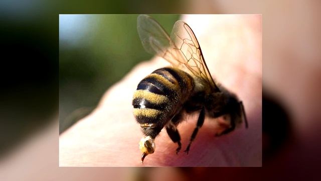 УКУС ОСЫ: ЧТО ДЕЛАТЬ? ПЕРВАЯ ПОМОЩЬ, ПОСЛЕДСТВИЯ ОТ УКУСА ОТ ОСЫ смотреть онлайн