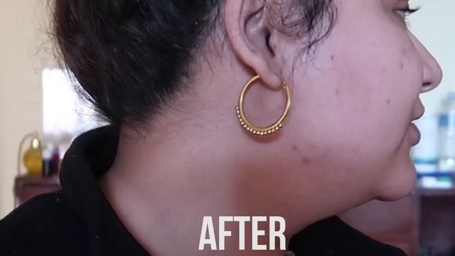 कया SkinKraft सच मैं अछा है? Honest Skincraft India review in Hindi??? смотреть онлайн