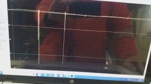 chevrolet cruze 2012 устраняем пропуски зажигания