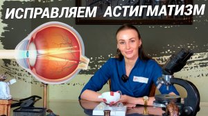 АСТИГМАТИЗМ: причины, лечение, упражнения! Как видит человек с астигматизмом и что делать?