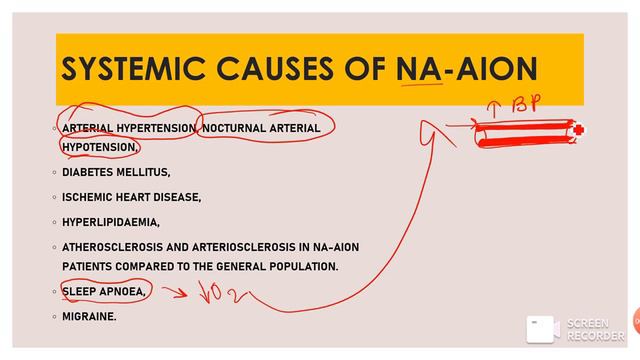 ISCHEMIC OPTIC NEUROPATHY || AION & PION || OPHTHALMOLOGY смотреть онлайн