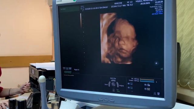 Кильметова Ирина Фиодосиевна (врач УЗИ) смотреть онлайн