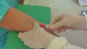 Забор крови из вены