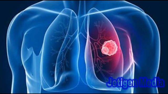 Мастопатияны жакшылап дарылаңыз. Эмчек рагынын белгилери, себеби, алдын алуу жолдору смотреть онлайн