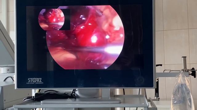 Трубная беременность 9 недель да смотреть онлайн