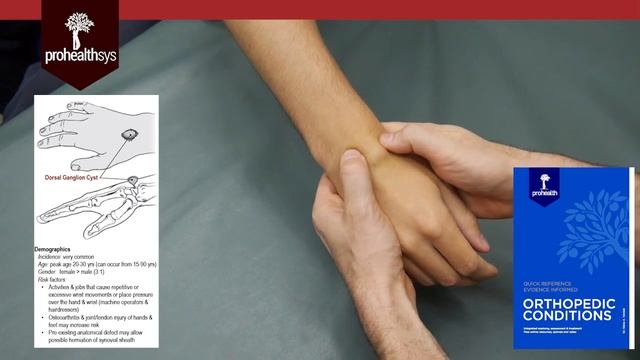 Ganglion Cyst of Wrist Diagnosis and Treatment Dr Vizniak смотреть онлайн
