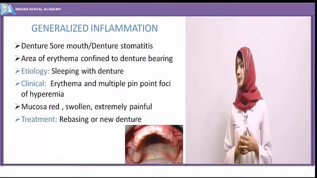 Physical and chemical injuries of oral cavity #NEET#NBDE#INDIANDENTALACADEMY смотреть онлайн