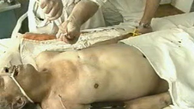 Reanimation2