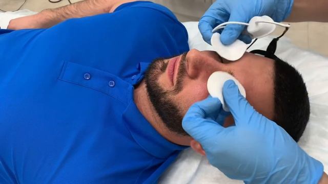 Фотоомоложение на аппарате Lumenis 22 смотреть онлайн