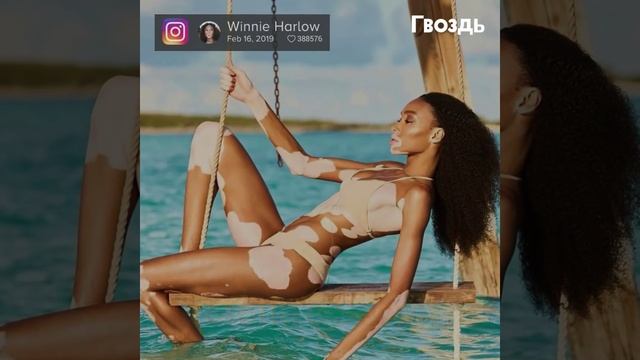 Врачи со слезами ставили диагноз. Через 15 лет болезнь сделала ее звездой. смотреть онлайн