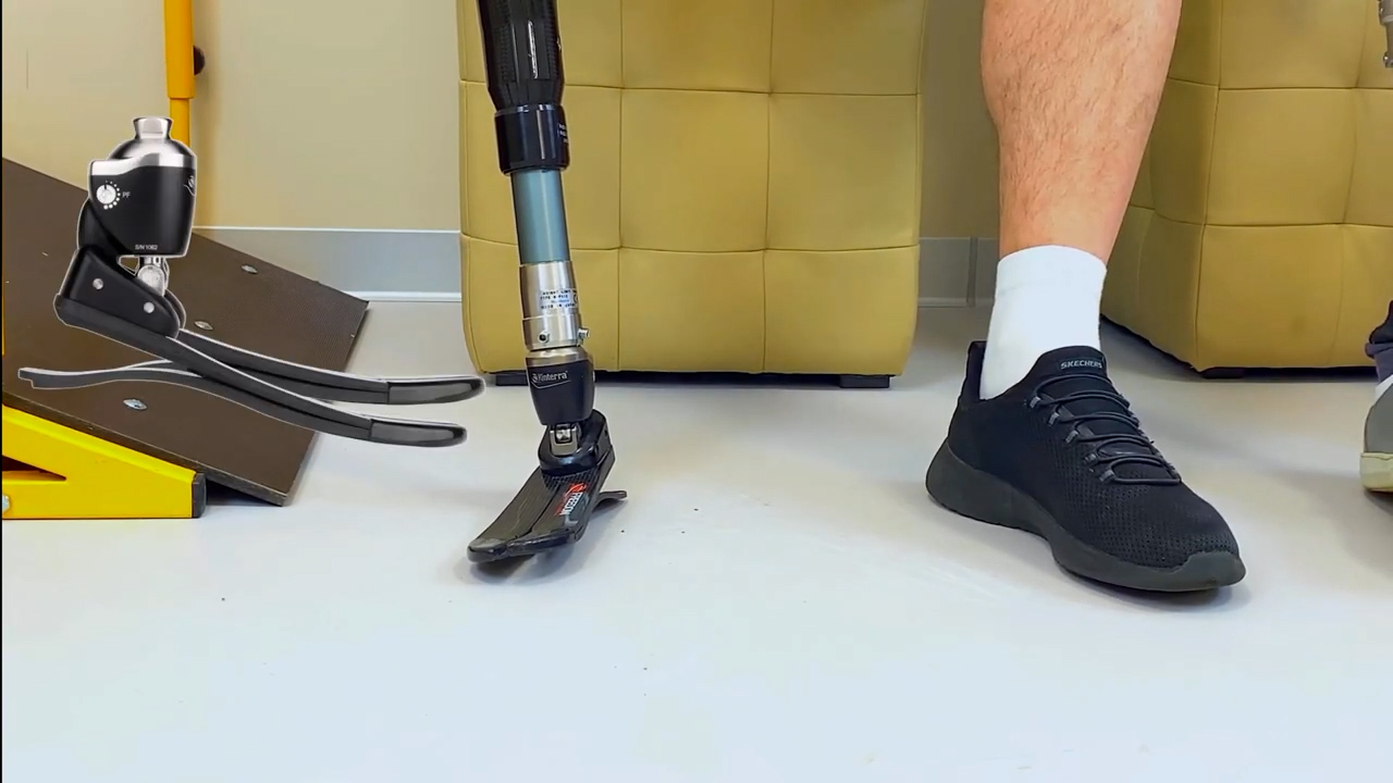 Всё о протезах ног. Часть 2: Карбоновые стопы "Хайлендер" и гидравлическая стопа "Кинтерра". смотреть онлайн