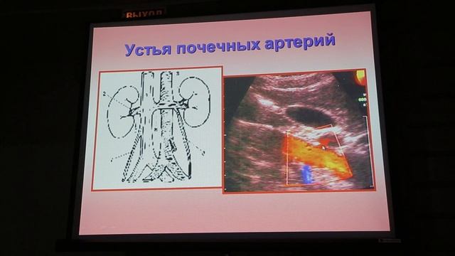 Кинзерский Допплерография висцеральных сосудов смотреть онлайн