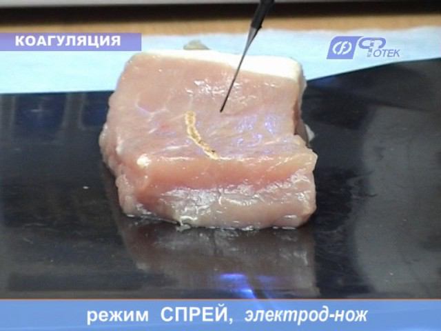 Видеоруководство по применению аппарата 