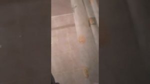 Промывание лакун миндалин дома с помощью канюли