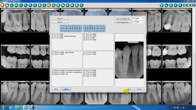 DEXIS™ Imaging Suite - Toolbar Overview Part Three смотреть онлайн