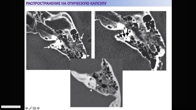 Травмы смотреть онлайн