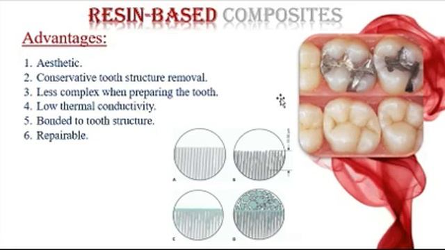 P1 resin base composite смотреть онлайн
