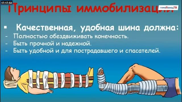 ПЕРВАЯ ПОМОЩЬ ПРИ ПЕРЕЛОМЕ КОНЕЧНОСТЕЙ