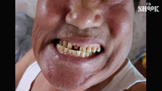 A Man Who Got Adult Tooth at the Age of 80🦷 смотреть онлайн