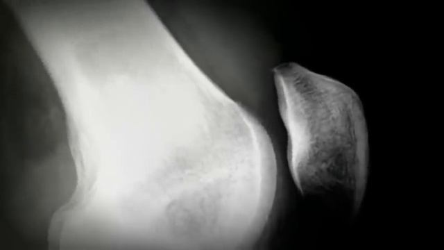 СТРАШНЫЕ ИСТОРИИ. Стукач. Часть 1. смотреть онлайн