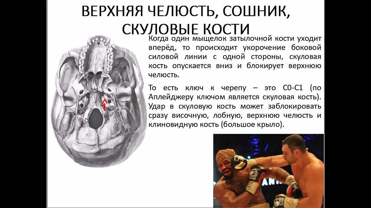 02 Семинар ЛИЦЕВОЙ ЧЕРЕП верхняя челюсть, сошник, скуловые кости смотреть онлайн