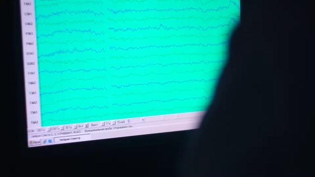 Электроэнцефалографические исследования смотреть онлайн