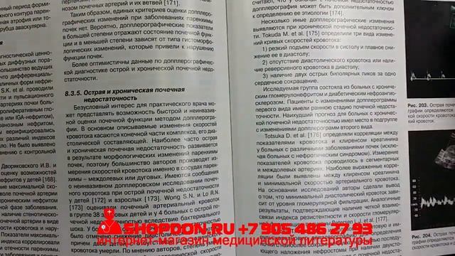 Книга "Практическое руководство по УЗИ диагностике. Общая УЗИ диагностика" - В. В. Митьков смотреть онлайн