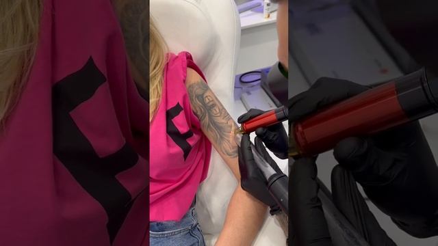 Удаляем (портрет) татуировку лазеромв клинике Sokolov Laser