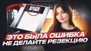 РЕЗЕКЦИЯ ЖЕЛУДКА/Я НЕ ПОХУДЕЛА?/МОЙ ОПЫТ