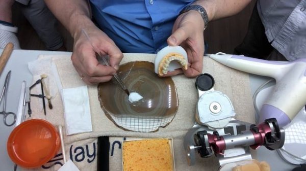 Kоррекция протяжённого моста в артикуляторе - Первая часть | Dr Vitali Nosov | #зубнойтехник