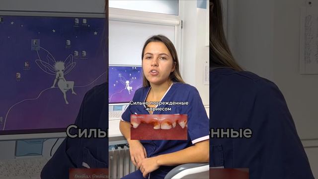 Нужно ли удалять молочные зубы в клинике❓ смотреть онлайн