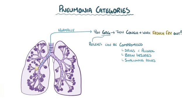 Pneumonia - Causes, Symptoms, Diagnosis, Treatment, Pathology
