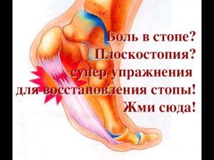 Голеностоп. Боль стопы. Упражнения для голеностопа восстановленные  связки РОС