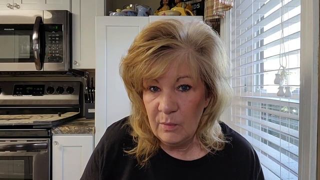 Reality Of DENTURES And FULL MOUTH EXTRACTION / Stages Of Grieving With Dentures