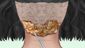 ASMR  Анимация лечения кожи головы