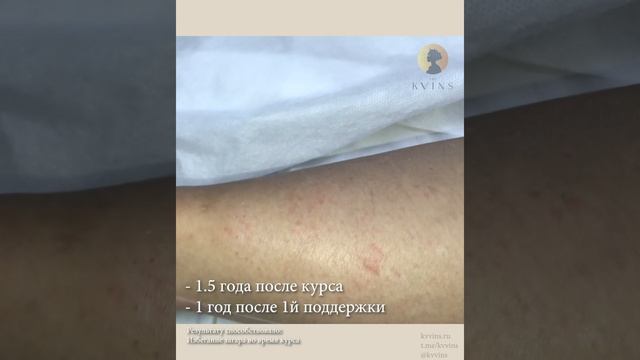 Пример результата после 1.5 лет после курса смотреть онлайн