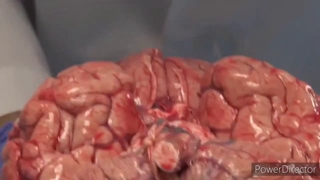 КАК ВЫГЛЯДИТ #МОЗГ ЧЕЛОВЕКА НА САМОМ ДЕЛЕ✅ АУТОПСИЯ✅ СТРОЕНИЕ МОЗГА смотреть онлайн