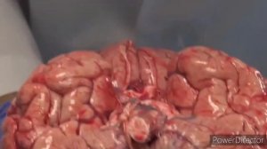 КАК ВЫГЛЯДИТ #МОЗГ ЧЕЛОВЕКА НА САМОМ ДЕЛЕ✅ АУТОПСИЯ✅ СТРОЕНИЕ МОЗГА