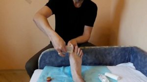 Лечение вросшего ногтя в домашних условиях