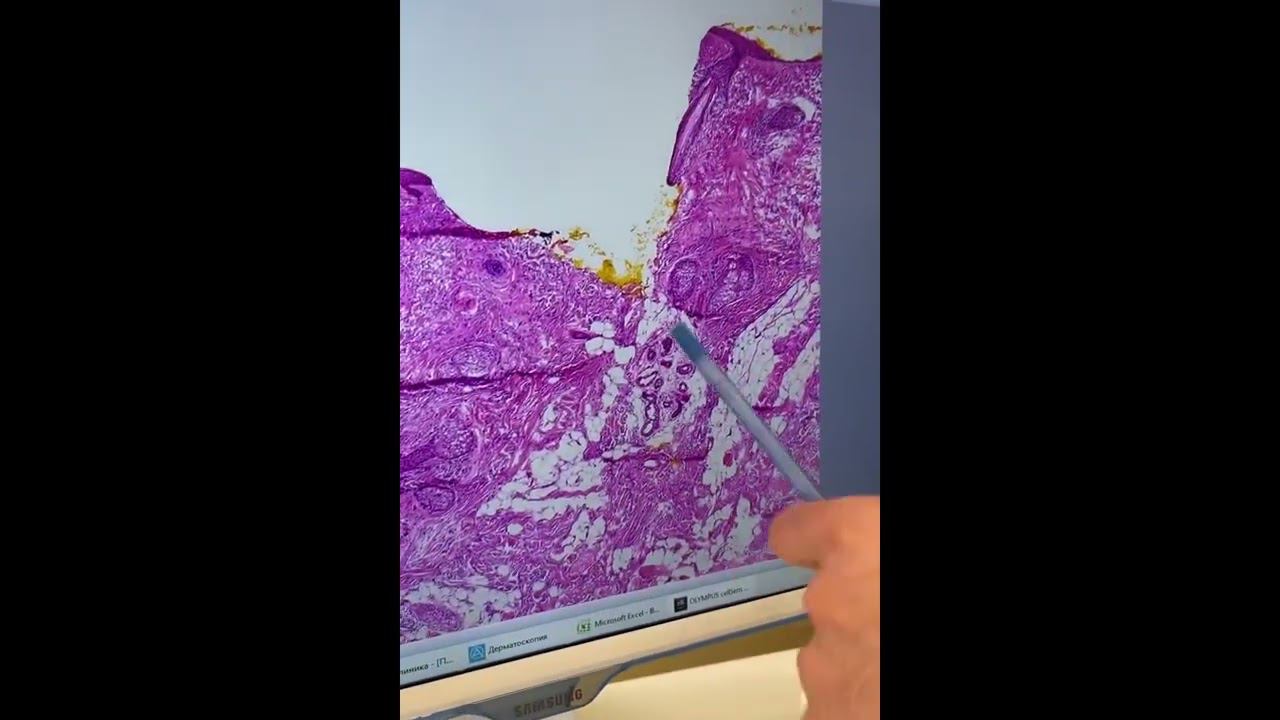 Видео 8 смотреть онлайн