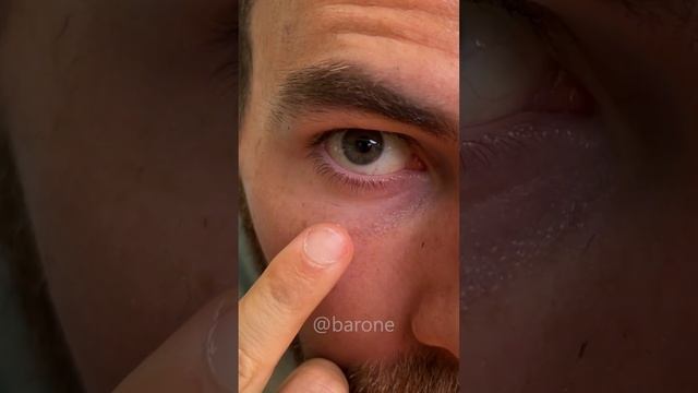 Esse creme milagroso promete remover manchas como se fosse mágica!? смотреть онлайн