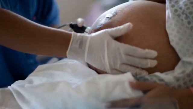 НЕ ВЫЗЫВАЙ РОДЫ САМА | 7 причин почему нельзя вызывать роды самостоятельно смотреть онлайн