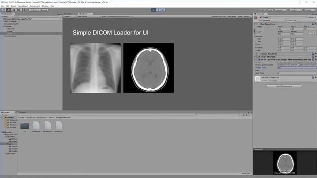 Simple DICOM Loader for Unity смотреть онлайн