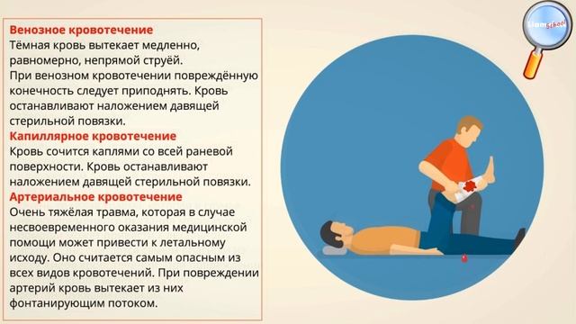 ОБЖ 11 класс Урок №4 Первая помощь при кровотечениях и ранениях