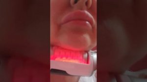 Эндосфера лица