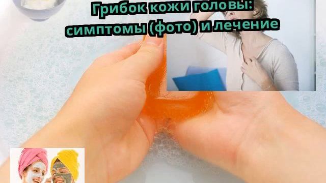 Грибок кожи головы: симптомы (фото) и лечение смотреть онлайн
