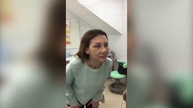 Снятие гипса после ринопластики, снятие стрипов после блефаропалстики, хирург Абрамян С.М. смотреть онлайн