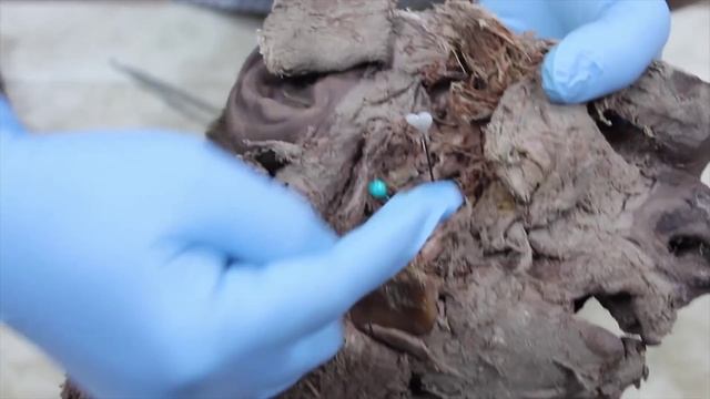 GIT - 3rd Year Anatomy Revision - Part 1 смотреть онлайн