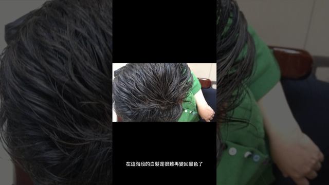 白髮位置能看出身體問題？3個位置代表你過勞！ смотреть онлайн